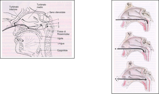 tecnica_catetere_tubarico