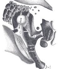 La Sindrome del muscolo tensore del timpano